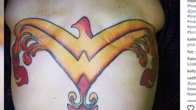 go to Nach Brustentfernung: Wonder-Woman-Tattoo zeigt Stärke